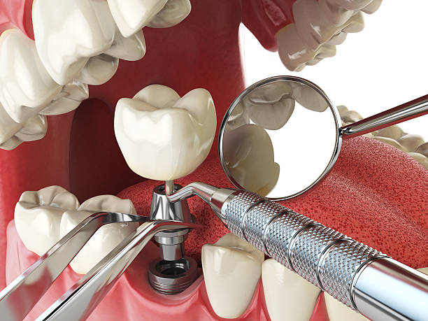 Best Emergency Dental Care for Abscessed Tooth in Mena, AR